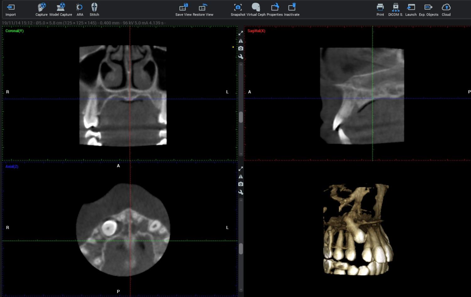 cbct